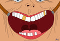 Nesten